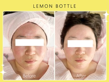 シロカネ 光の森店(SHIROKANE)/レモンボトル☆