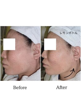 グラシア(gracia)/シミ・毛穴ケア専門店gracia