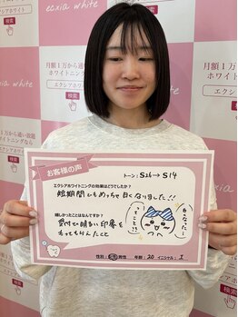 エクシアホワイトニング 倉敷店/お客様の口コミをご紹介☆