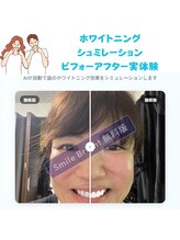 ホワイトニングショップ 池袋店/ホワイトニングシュミレーション