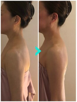 ミルキー(Milky)/巻き肩さんは疲れやすい