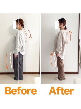 整体院ひなた 都城院/産後骨盤-9cm!腰痛/肩こり改善!!