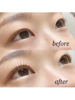 アイ(_i)/ラッシュリフト