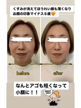 カイロプラティックアンズ(chiropractic&‘s)/98％が寝落ち！魔法のヘッドスパ