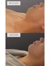 【小顔人気Ｎｏ．1】あご肉さよなら小顔コース60min ＼リピーター続出中!!／