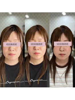 ダリア(Dahlia)/大満足★オニキス160shot