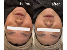 マハロ(mahalo)/くすみケア