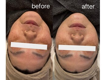 マハロ(mahalo)/くすみケア