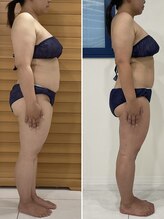 エゴ(EGO)/40代前半　153cm 5.0キロ減