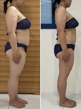 エゴ(EGO)/40代前半 153cm 5.0キロ減