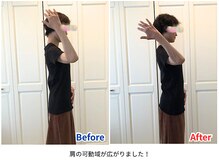 ラシュシュ/ビフォーアフター