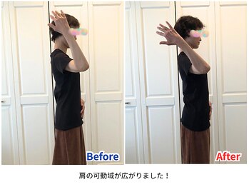 ラシュシュ/ビフォーアフター