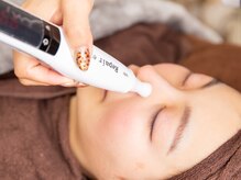 リートライ(Re Try)/細かいチップで部分照射