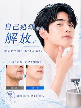 キレピア 新市街店(kirepia)の写真/毎朝のヒゲ剃りから解放された快適な生活へ