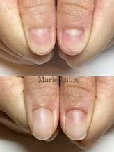 マリーロール 梅田店(Marie Laure)/自爪育成/深爪矯正/ネイルケア