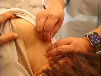 マチノマ(machinoma)/鍼