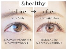 アミレ 表参道(amire)/&healthy 140本