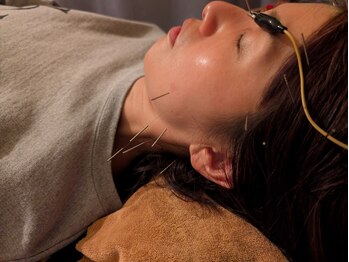 カンワ美容鍼灸院(KANWA美容鍼灸院)/眼精疲労もスッキリ！