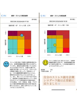 ディラ(deela)/施術の前後をグラフで表記