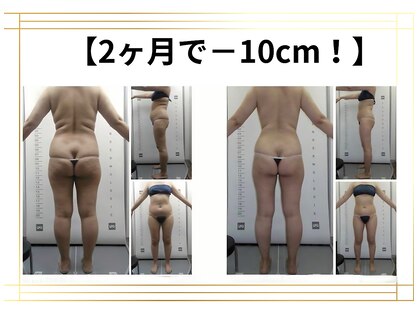 スパイア(SPIRE)の写真