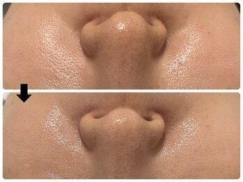 エフェクト 塚口店(effect)/Before After 30代/3回目