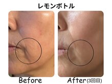 ラディアント たまプラーザ/《レモンボトル》