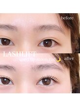 ブラン 小倉店(Blanc)/まつげパーマ　ビフォーアフター