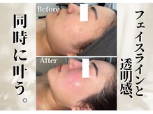 リリーシャ 赤坂(LILISHA)/浮腫みくすみを取り、小顔を造形