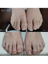 ハロ(Halo)/ケア付きフット磨き仕上げ