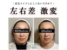 小顔効果だけなく顔の左右バランスも均等に。顔質が変わります。