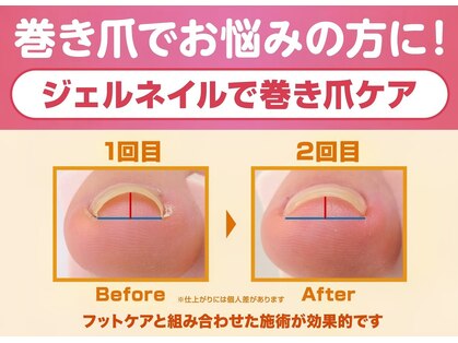 オーラリー ネイル アート メゾン(ORRERY nail art maison)の写真