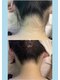 ローズ(Rose)の写真/初めての方、学生さんにもおすすめ！メンズにも効果実感◎痛みの少ない全身脱毛でつるすべ美肌へ♪