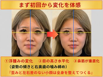 メディピークス/初回の変化確認