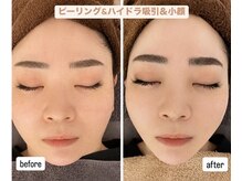 アンドグレイスプラス 恵比寿(&Grace+)の雰囲気（◎一度で小顔/解剖学を基に神ハンドで★理想小顔でたるみ改善♪）