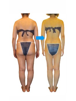 エステティック アントワネット/第5回FTIコンテスト1位を獲得☆