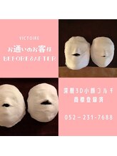 ヴィクトワール(Victoire)/１回目～１０回目の違いを体感