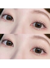 フィールリファイン(Feel Refine)/ラッシュリフト