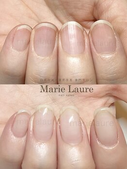 マリーロール 淀屋橋本店(Marie Laure)/自爪育成/深爪矯正/ネイルケア