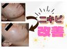 【韓国肌トリートメント】毛穴洗浄+ムルトックス+パック　60分　9,800円