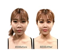 ビーホリック(Bholic)の雰囲気（健康理論に基づいた痛みの少ない施術で内側から輝く美と健康を◎）