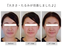 エピファニー(Epiphany)/30代　昔より顔が大きくなって…