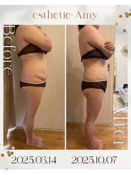 エイミー 藤ヶ丘店(Amy)/before→after