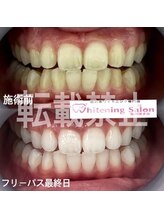 ホワイトニングサロン 福岡博多店/ホワイトニング