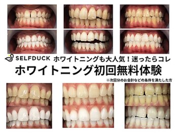 ミモアサロン 岡崎店(mimoaサロン)/ホワイトニングTOP