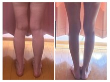 美容整体カラダリメイク(karada)/骨盤矯正ダイエットの結果