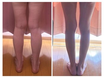 美容整体カラダリメイク(karada)/骨盤矯正ダイエットの結果