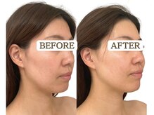 ソナ 大和西大寺院(SONA)/