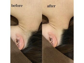 オアシスサカエ(OASIS SAKAE)/【襟足脱毛】