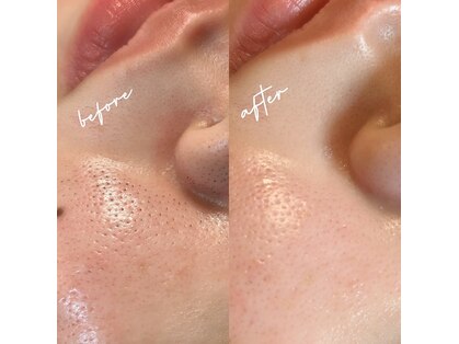 ロコワックス(Loco wax)の写真