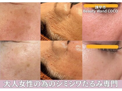 ビューティーワンド ココ(Beauty Wand COCO)の写真